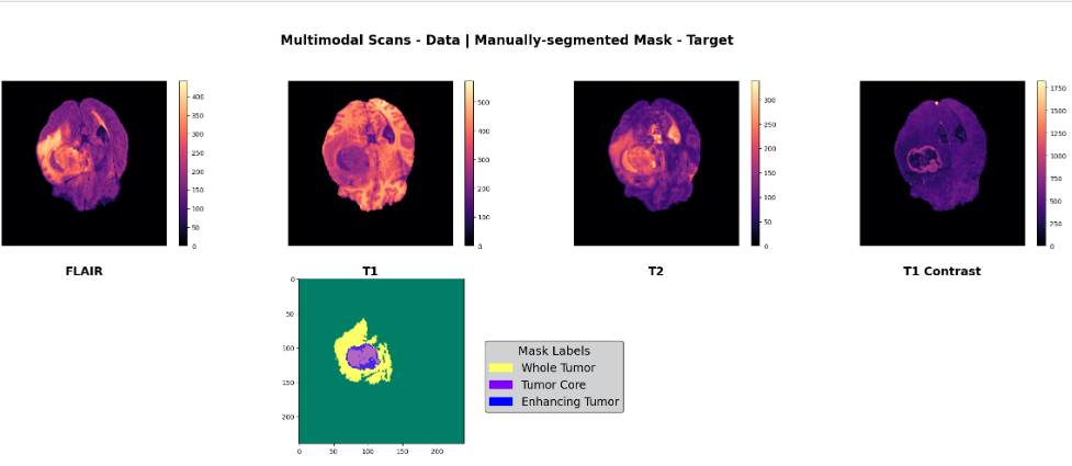 Brain Tumor Segmentation